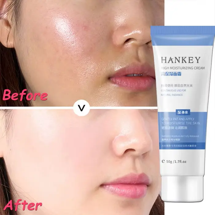 Crème Réparatrice Anti-Rougeurs Visage – Hydratant Apaisant pour Peaux Sensibles – Élimine la Rosacée et les Varicosités – Cosmétique Coréen